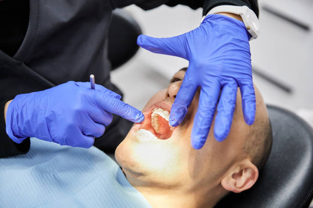 Best Emergency Tooth Extraction in South Charleston, OH